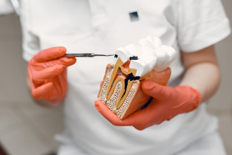 What to Expect During Modern Root Canal Therapy