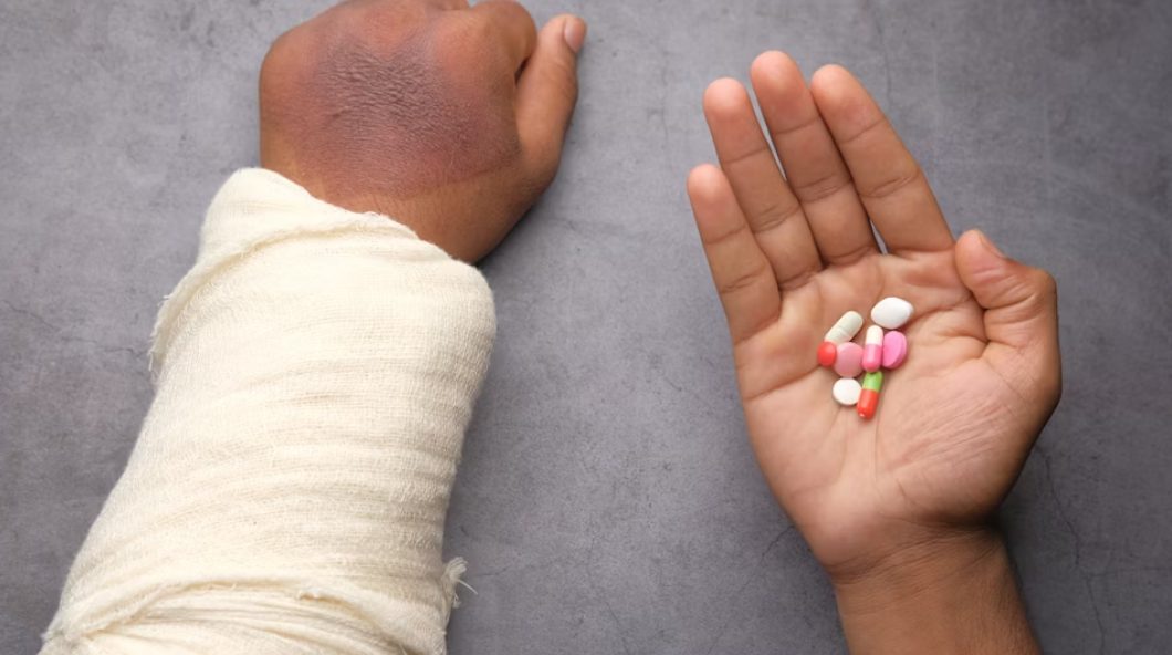 Breakthroughs in Arthritis Treatment and Care