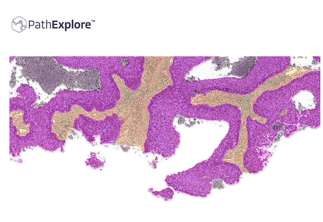 PathAI Expands PathExplore Reach to 14 Cancer Types