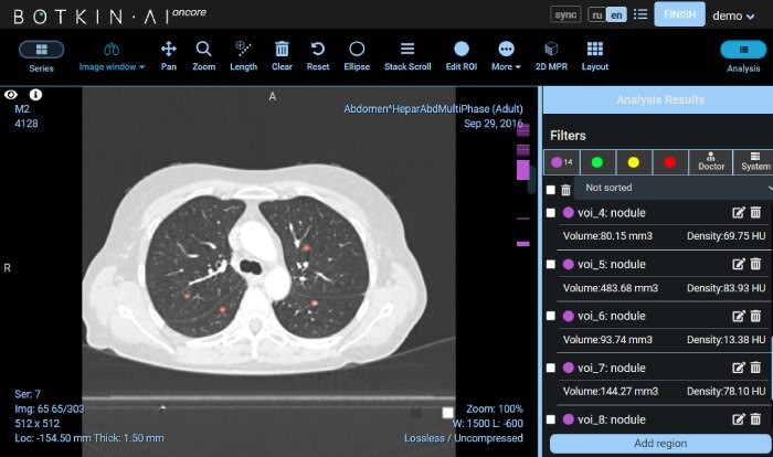 Moscow DOH uses AI platform to detect lung cancer symptoms