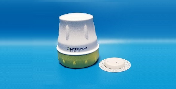 Metronom Health's Continuous Glucose Monitoring