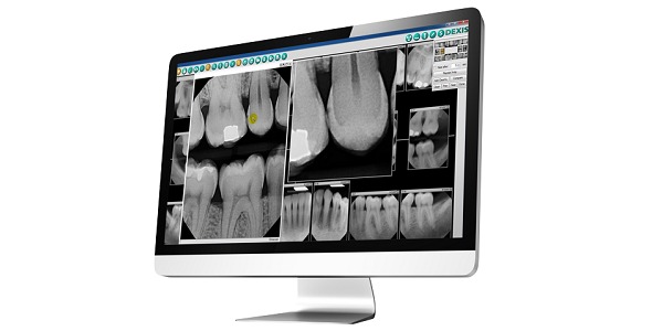 DEXIS™ Imaging Suite Software