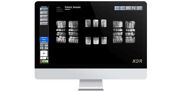 XDR's Dental Imaging Software