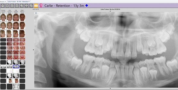 Ortho2 Edge Imaging