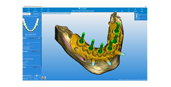 RealGUIDE™ Software Suite