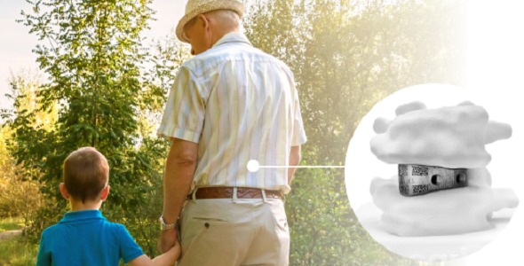 Aprevo® intervertebral body fusion device by Carlsmed®