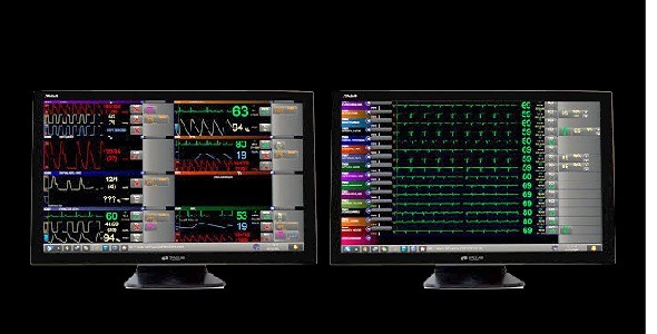 Spacelabs - Patient measurement