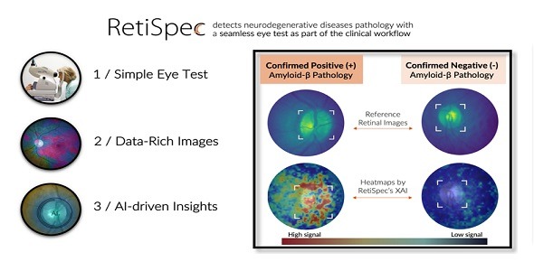 RetiSpec - AI imaging