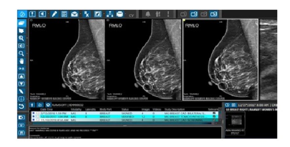 RamSoft - Mammography