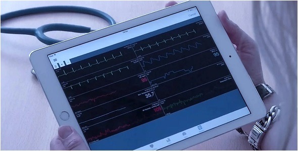 Dyna-Vision Telemonitoring System
