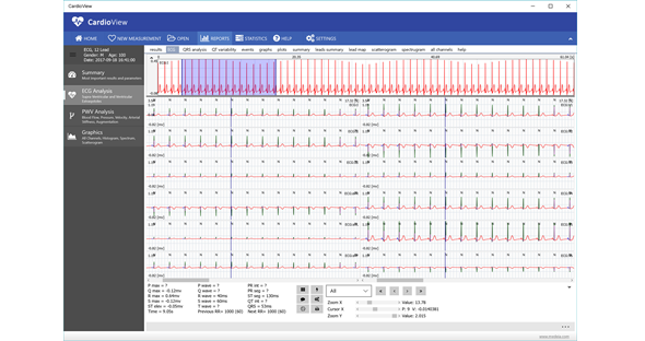 BioSigns Monitoring Quality Report Software