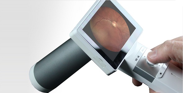 Fundus Camera