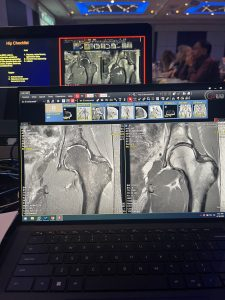 STOLLER: A Comprehensive Tutorial in Musculoskeletal Imaging Using the Stoller Checklist Technique