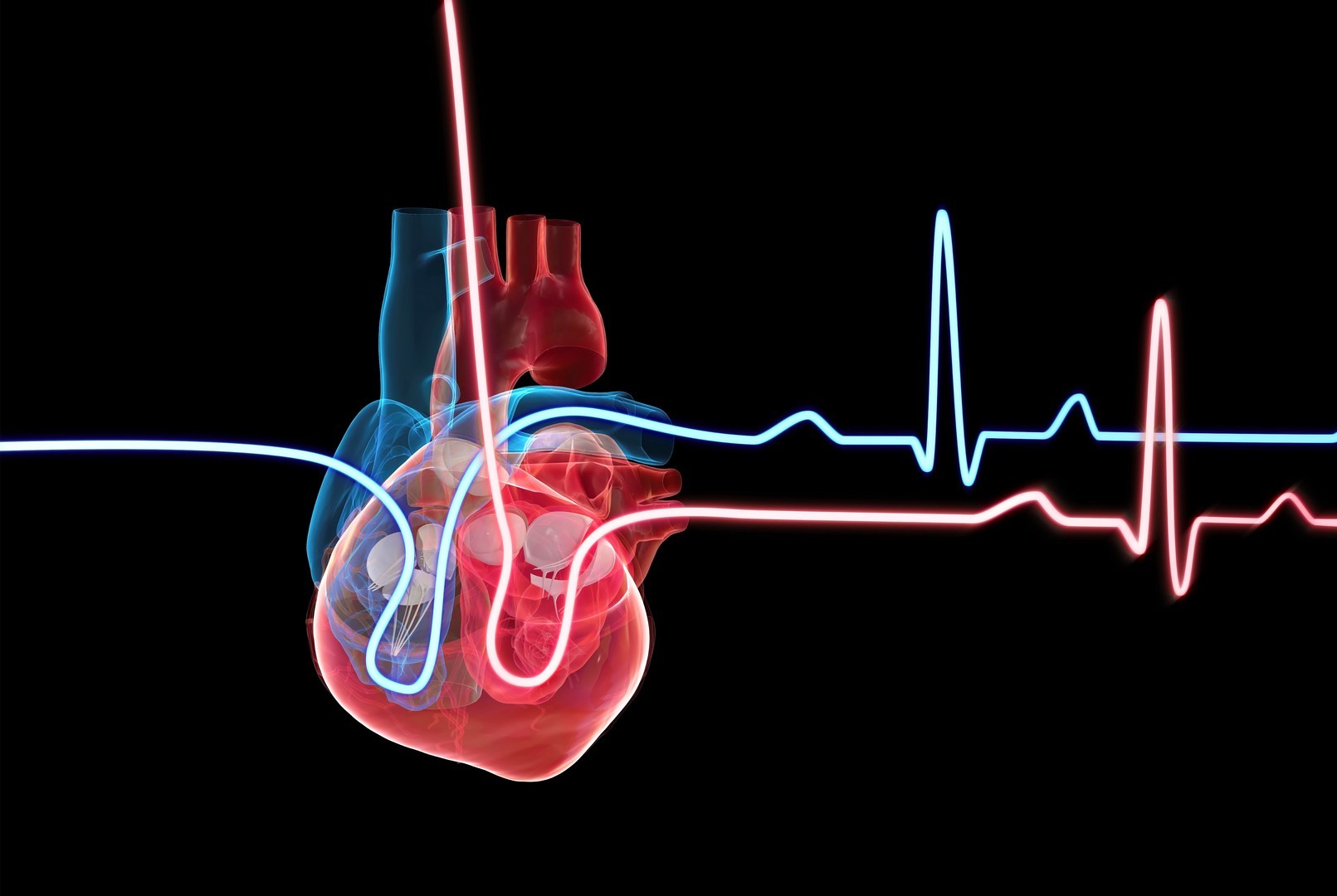 Cardiac Rhythm Device 2022 CNE Conference, Rochester, MN