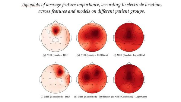 Machine Learning and Its Potential to Improve Epilepsy Diagnosis