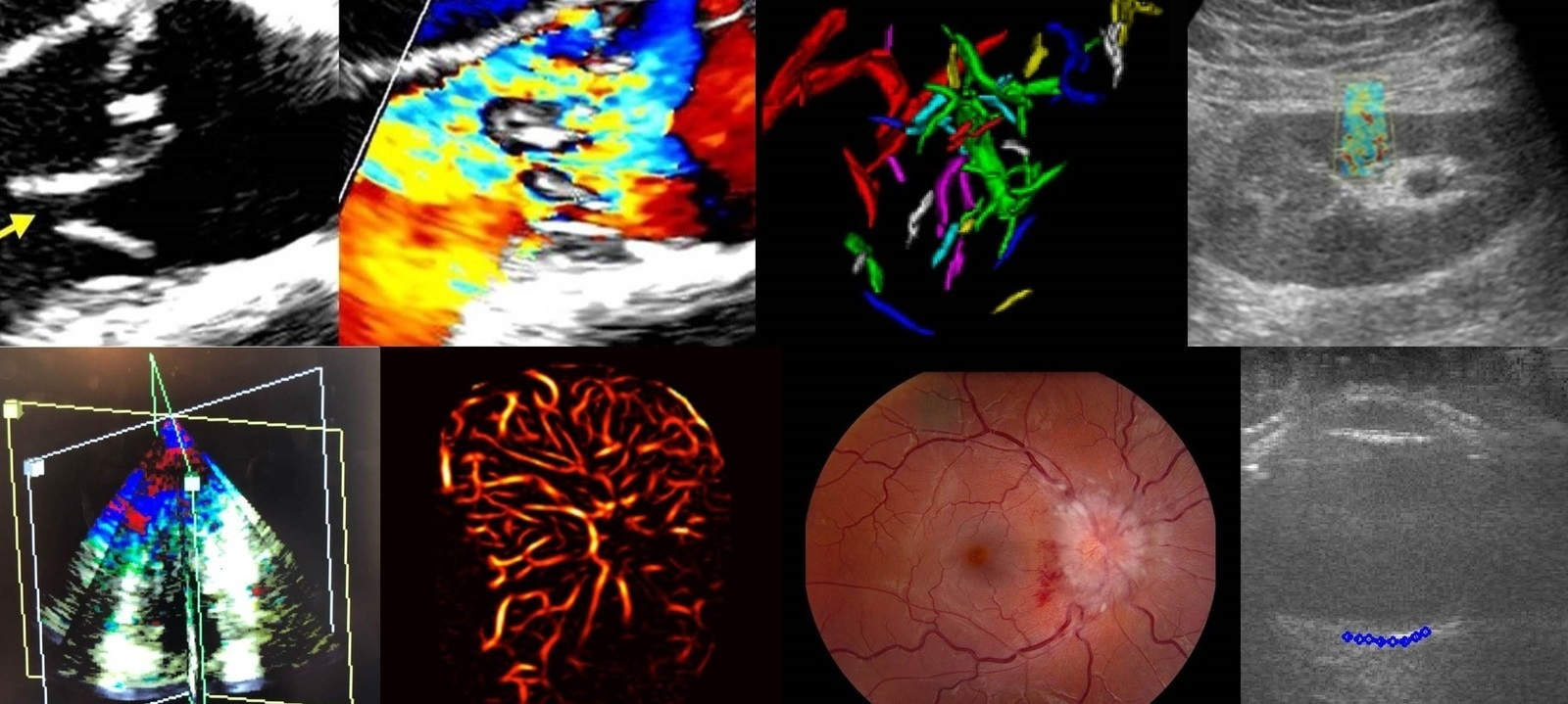 Tutorials in Diagnostic Radiology 2023