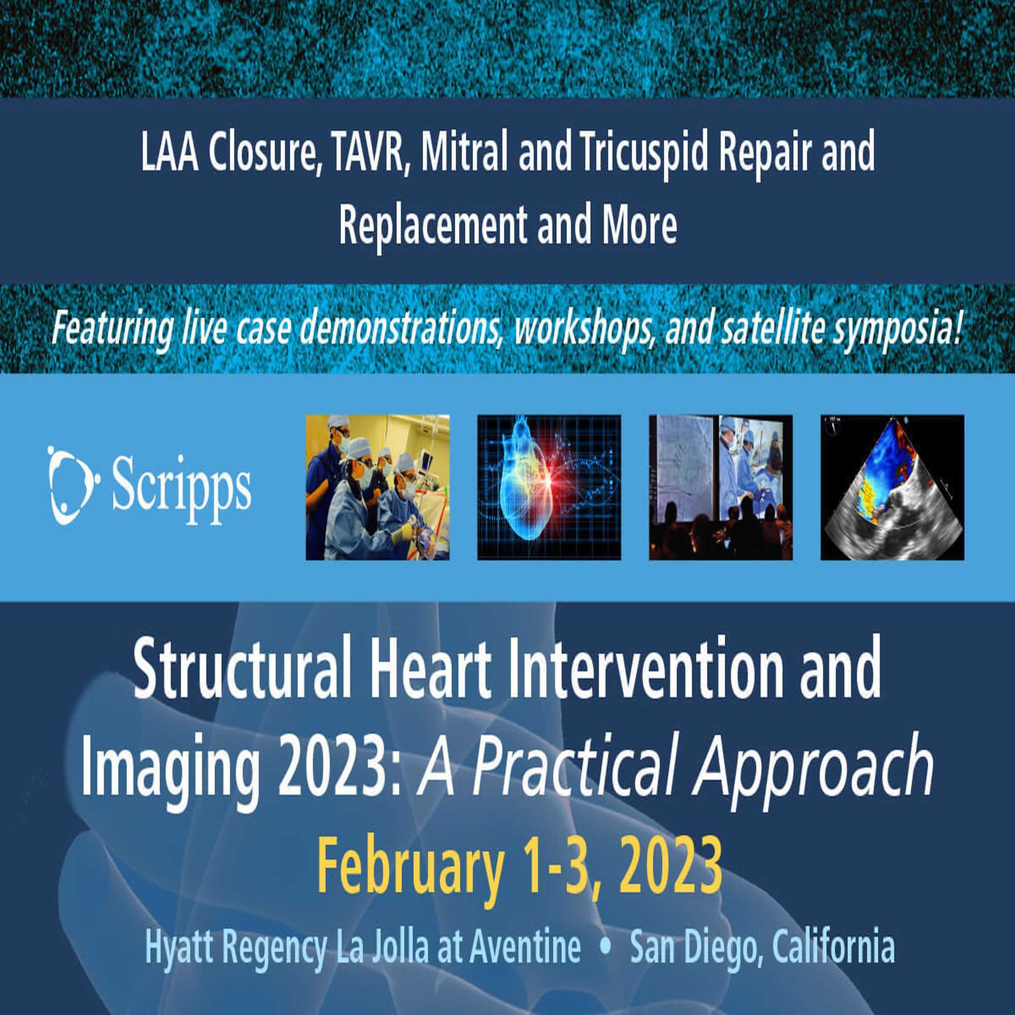 Scripps Structural Heart Intervention and Imaging 2023 CME Conference - San Diego, California