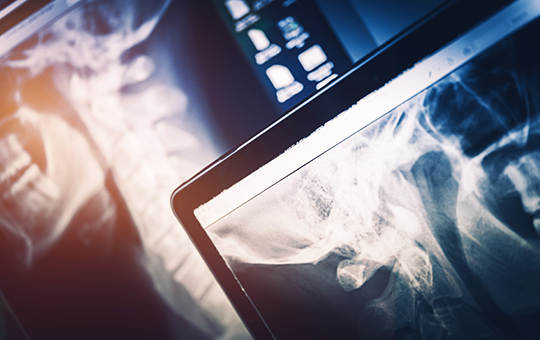 Digital Imaging Summit 2022: Improving Radiology Reporting & Escalation
