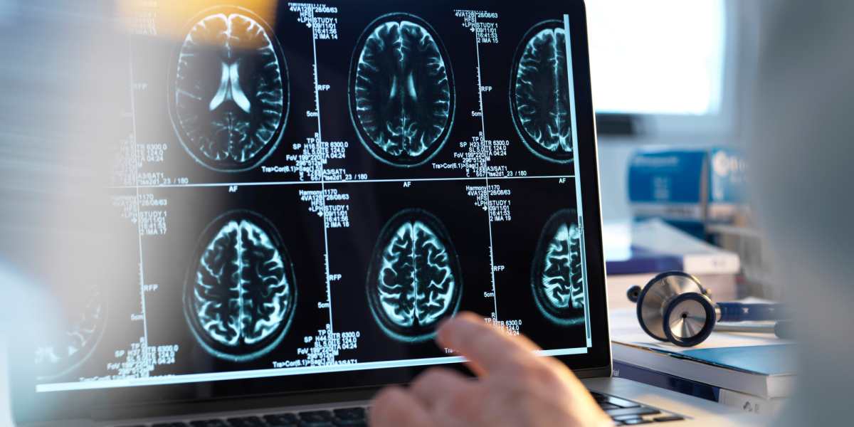 Microsoft Quantum Algorithm Boosts Medical Imaging