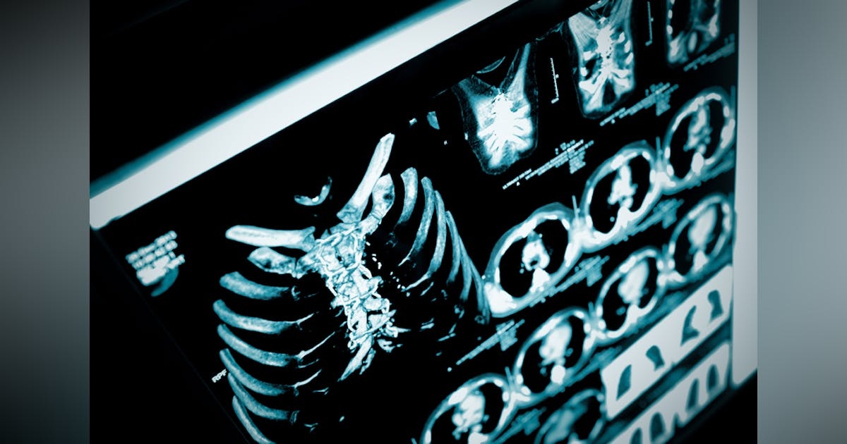 At RSNA, Experts Warn of Danger from Malicious Use of AI Against Radiology