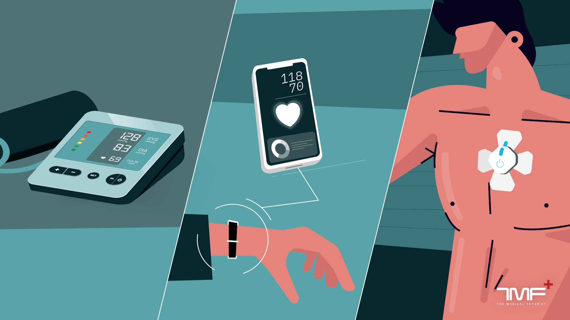From Cuff To Cuffless: The Evolution Of Blood Pressure Monitoring