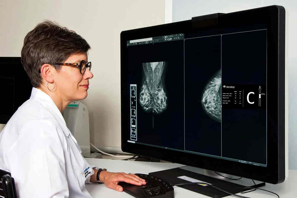 Intelerad, Densitas Partner on AI-Powered Breast Cancer Screenings