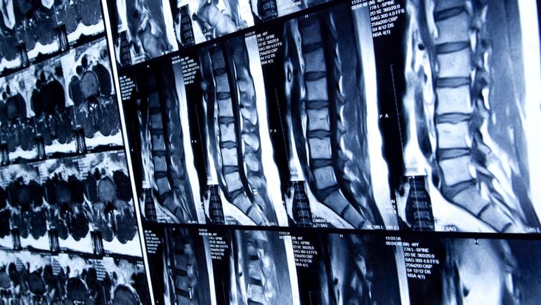 GE HealthCare partners with J&J to push spine imaging system