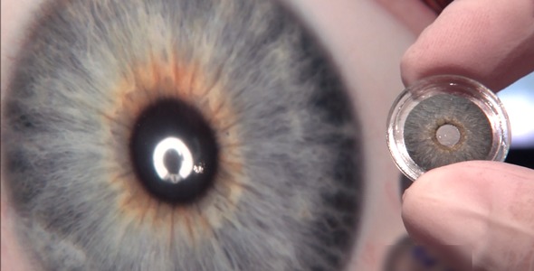 CustomFlex Artificial Iris by HumanOptics