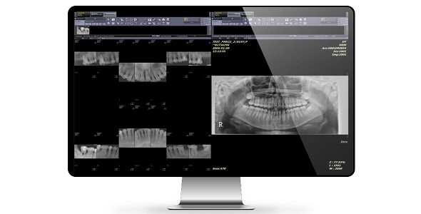 INFINITT Versity Dental Platform