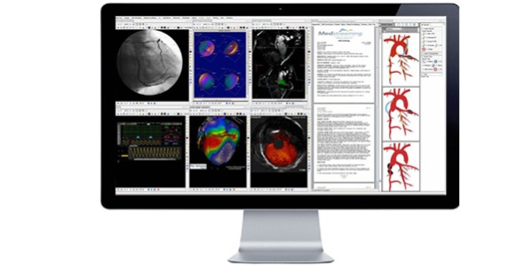 Cardiovascular Information System (CVIS)