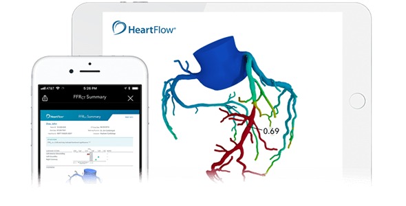 HeartFlow FFRCT Analysis